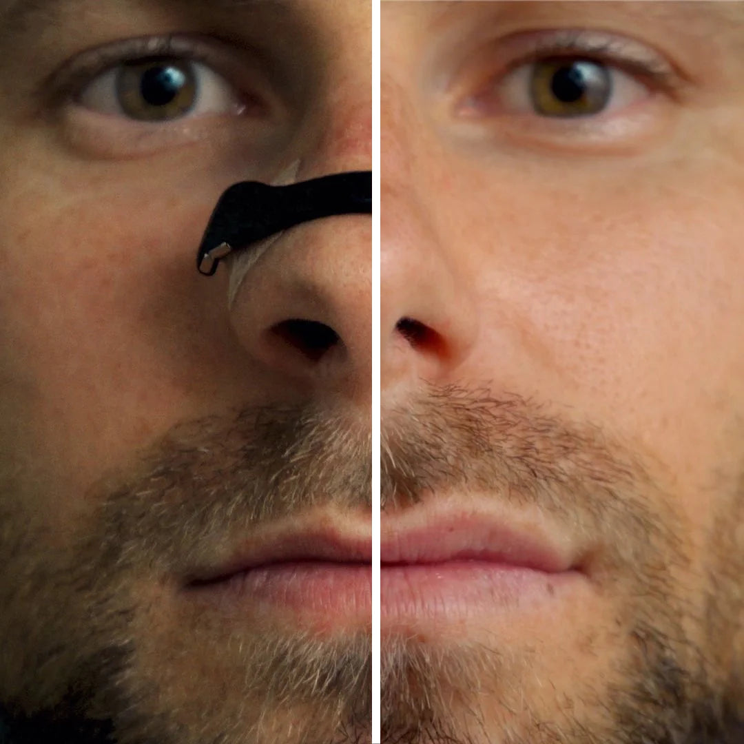 Magnetic Anti-Snoring Nasal Strips
